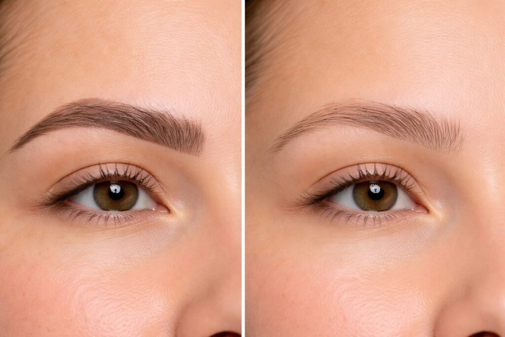 Permanent Make-Up entfernen im Überblick Permanent Make-Up entfernen
