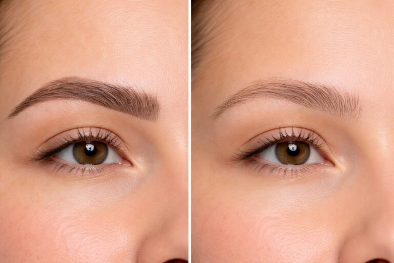 Permanent Make-Up entfernen im Überblick Permanent Make-Up entfernen